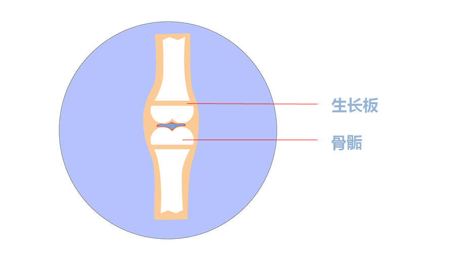 骨骺线位置图片图片